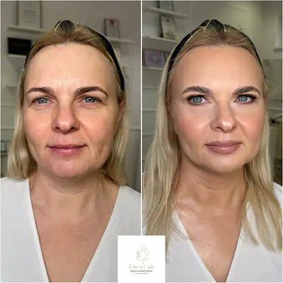 FaceLab Olena Zasadzińska-Markowska kosmetolog
